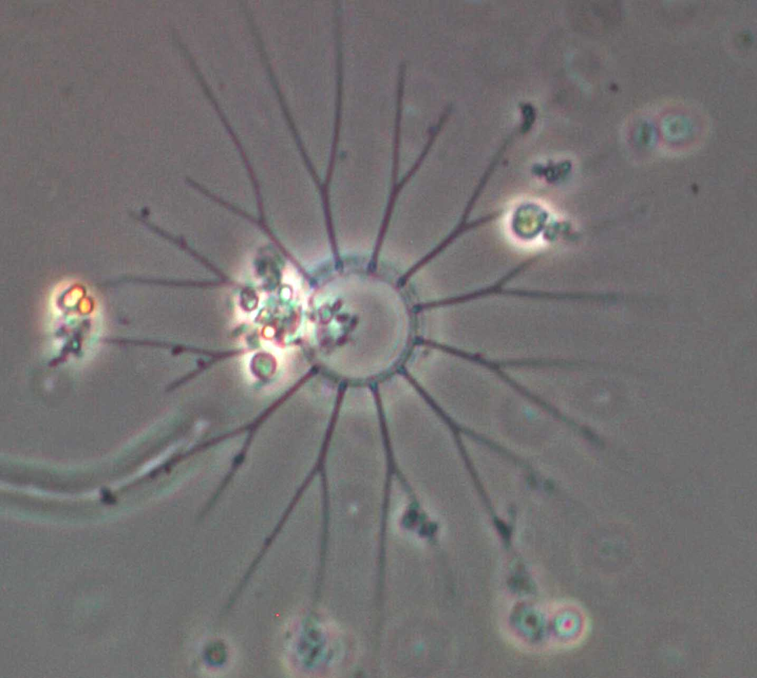 Bacteriastrum hyalinum